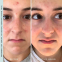 'Epidermal Growth Factor Activating' Gesichtsserum - 30 ml