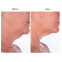 'Neck Amour' Anti-aging treatment - 50 ml