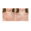 'Neck Amour' Anti-aging treatment - 50 ml