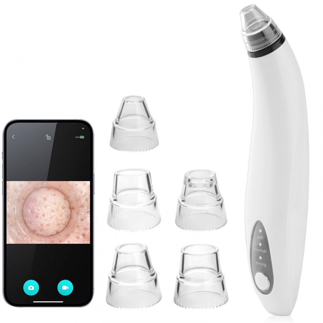 'Integrated Camera' Blackhead Vacuum