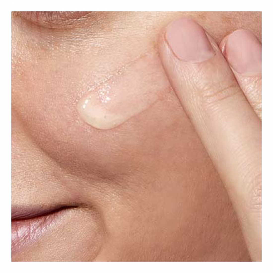 Retinol 'Anti-Marques' - 30 ml