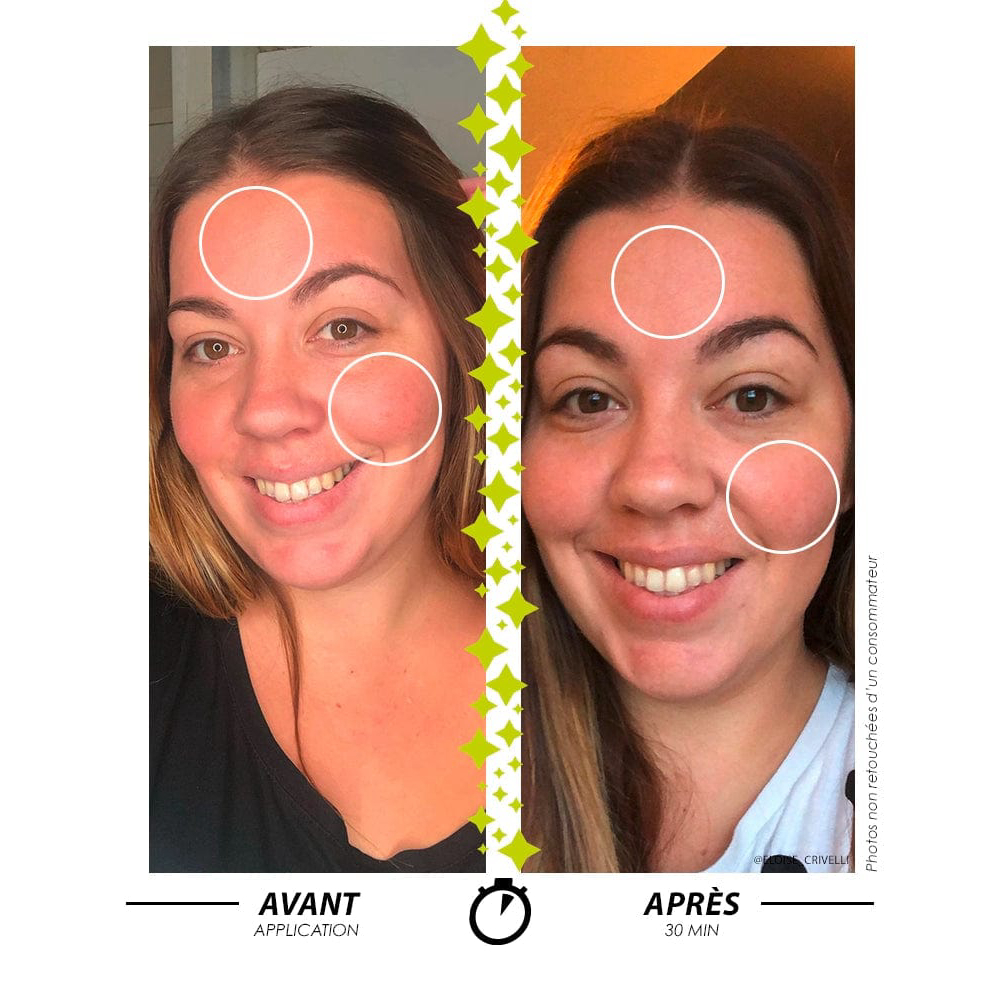 Sérum pour le visage 'Que Mes Rougeurs Disparaissent' - 30 ml