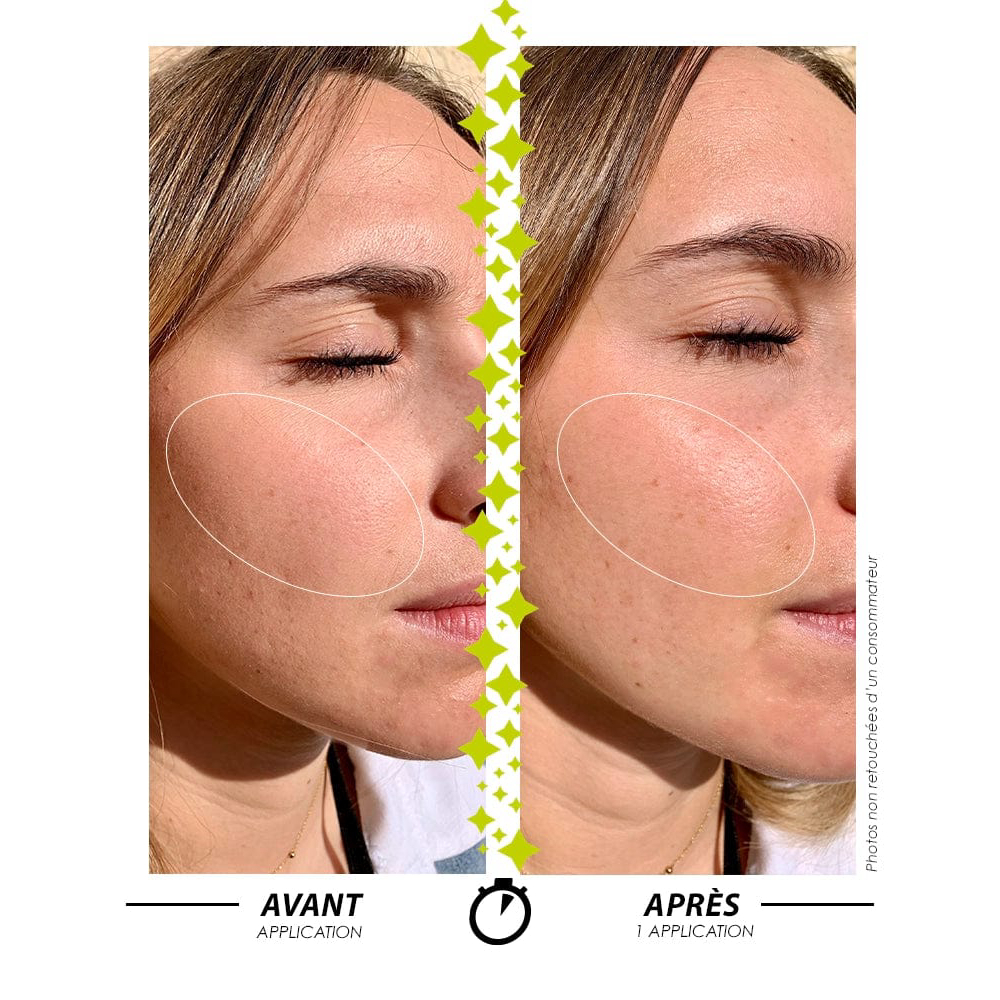 'L'Appel de la Forêt Booster Vitamine C' Doppel-Serum - 8 ml