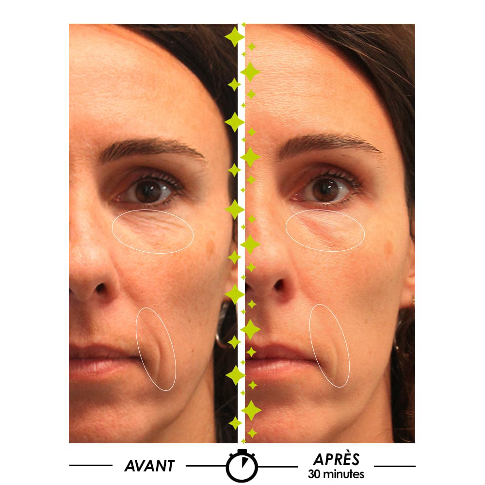 'Mystérieux Repulpant' Concentrate Serum - 30 ml