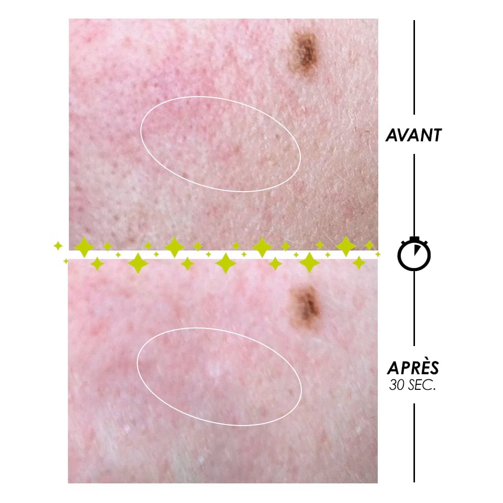 'Pschitt Magique' MiKro-Peel - 100 ml