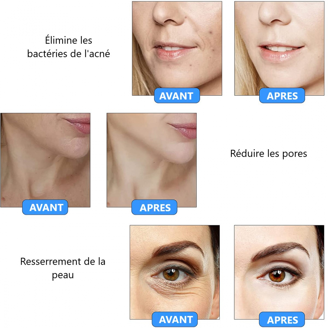 Correcteur de taches 'Stylo Anti Imperfection'