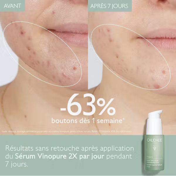 Vinopure Sérum Salicylique Anti-Imperfections - 30 ml