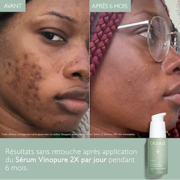 Vinopure Sérum Salicylique Anti-Imperfections - 30 ml