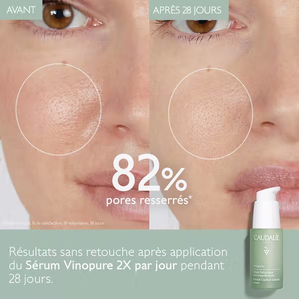 Vinopure Sérum Salicylique Anti-Imperfections - 30 ml