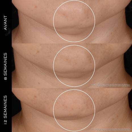 'Rénergie H.P.N. 300-Peptide' Anti-Aging Cream - 50 ml