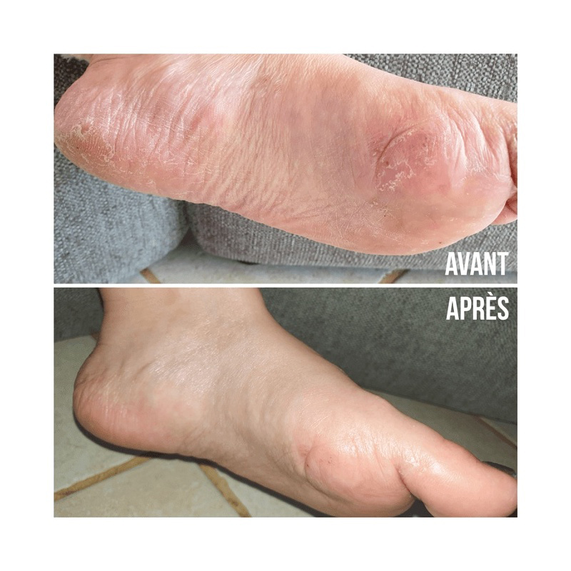 'Les Chaussons de Soin' Foot Mask - 15 ml, 1 Pair