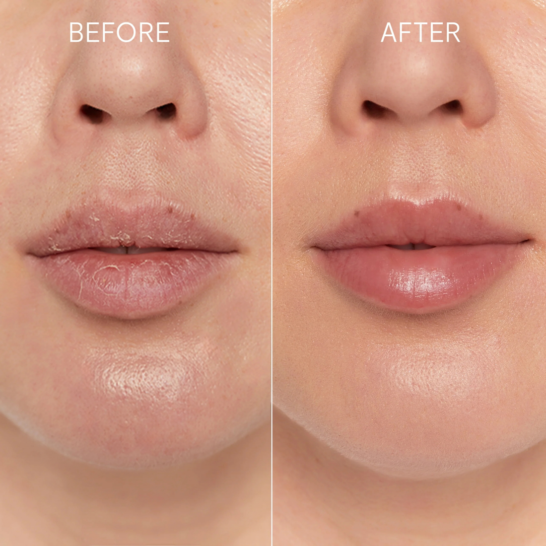 Lip Regeneration Duo Set