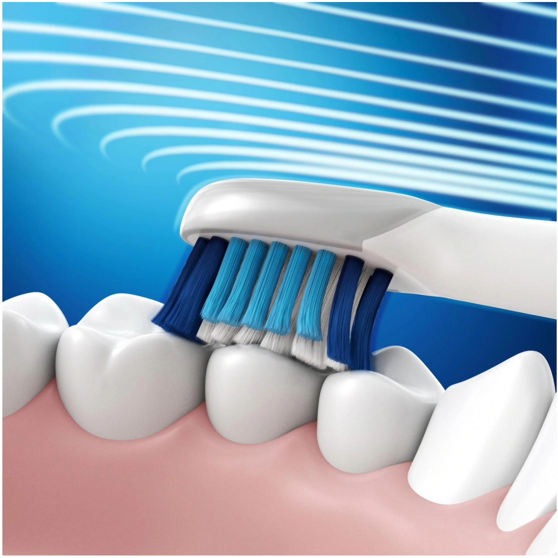 Tête de brosse à dent 'Pulsonic Sensitive' - 4 Pièces