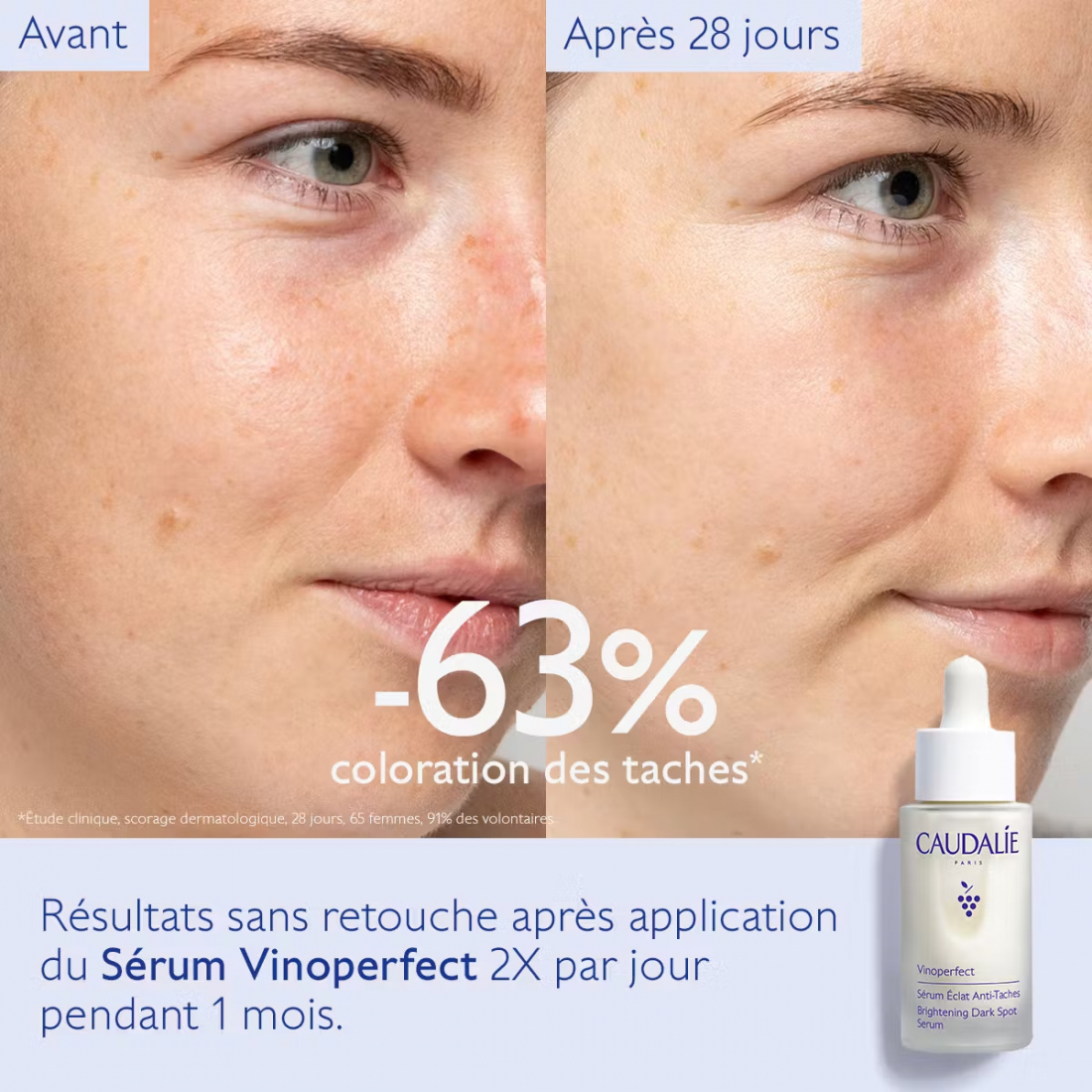 Vinoperfect Sérum Éclat Anti-Taches - 30 ml