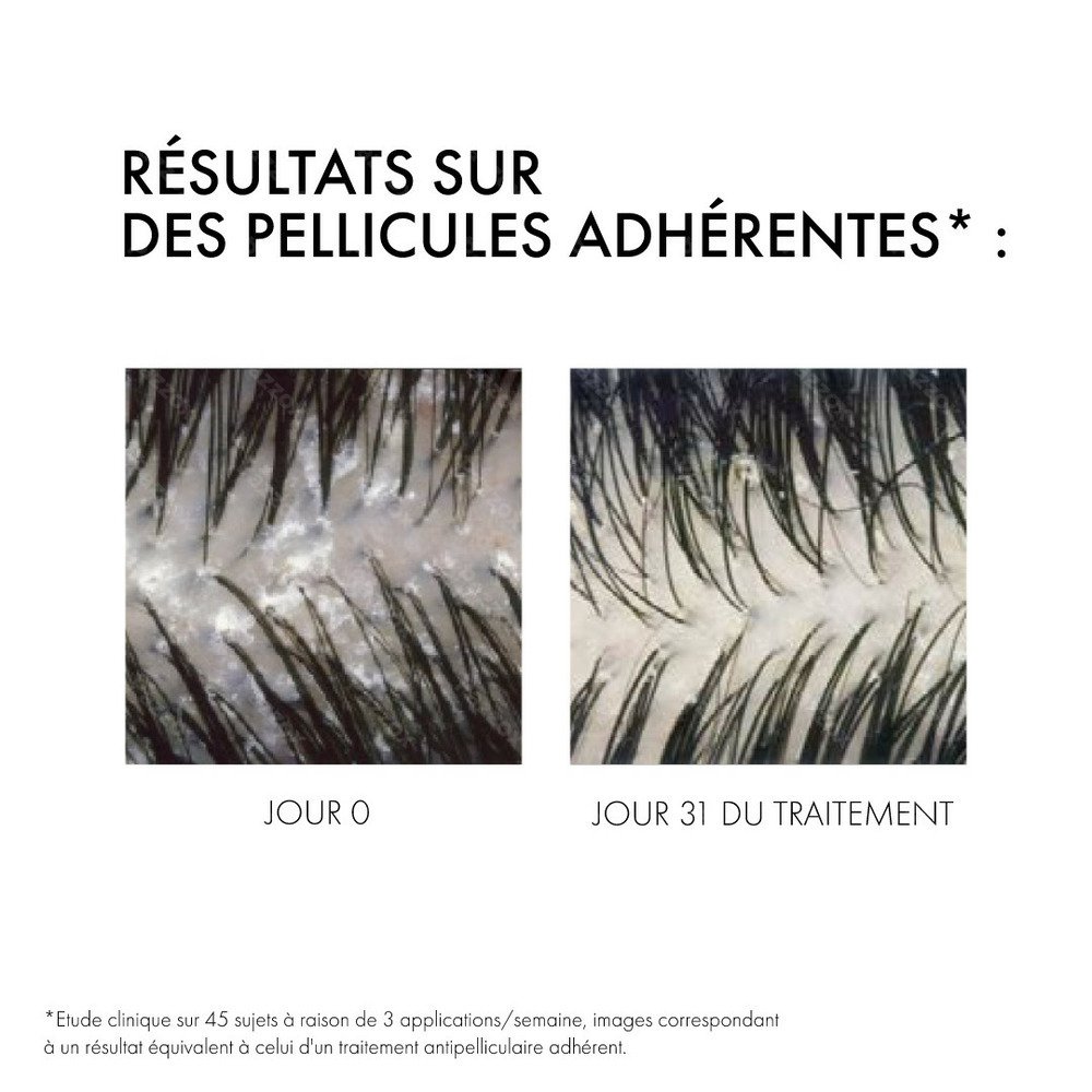 'Dercos' Dandruff Shampoo - Normal to Oily Hair 200 ml, 2 Pieces