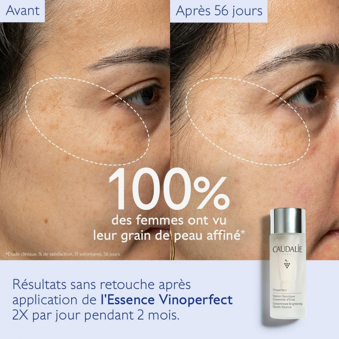 'Vinoperfect Concentrated Brightening Glycolic' Essence - 100 ml