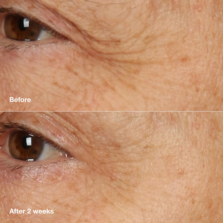 'Smart Clinical Repair™' Night Cream - 50 ml