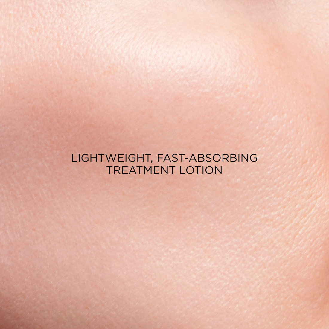 'Intral Daily' Treatment Lotion - 150 ml