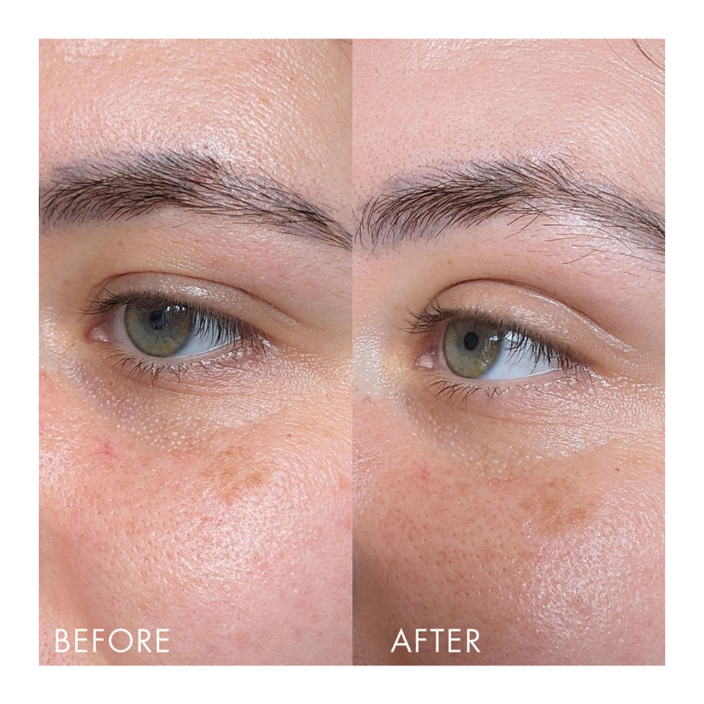 'Time Retreat Smoothing Eye Complex' Augenbehandlung - 15 ml