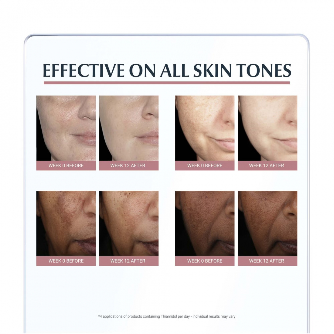 'Anti-Pigment SPF30' Day Cream - 50 ml