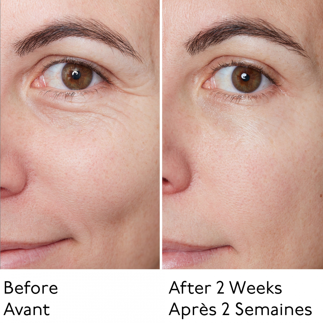 'Hyaluronic Global' Face Serum - 30 ml