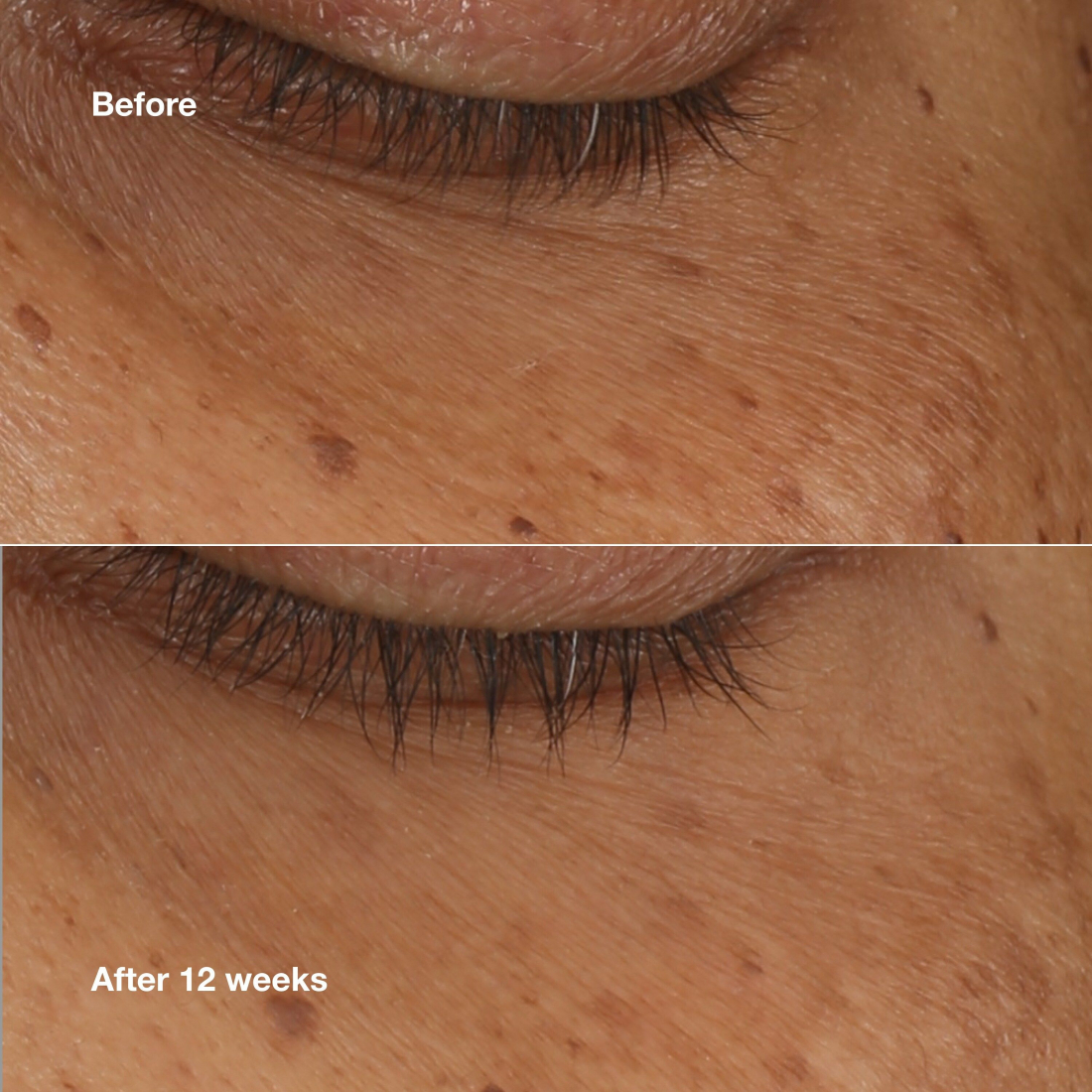 'All About Eyes™ Brightening' Konzentrat-Serum - 10 ml