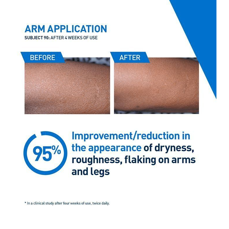 Lotion hydratante 'Intensive' - 473 ml