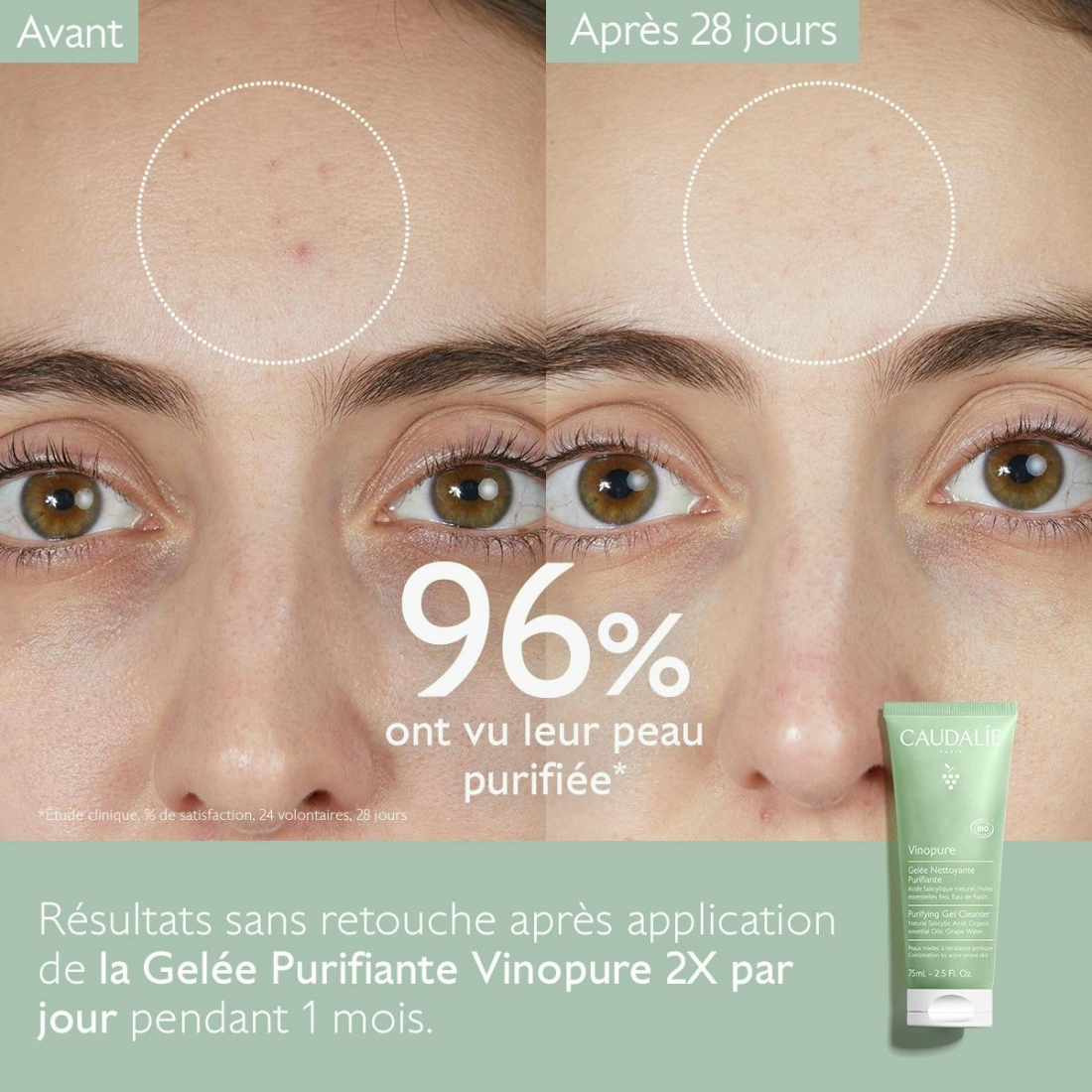 'Vinopure Purifying' Reinigungsgel - 75 ml