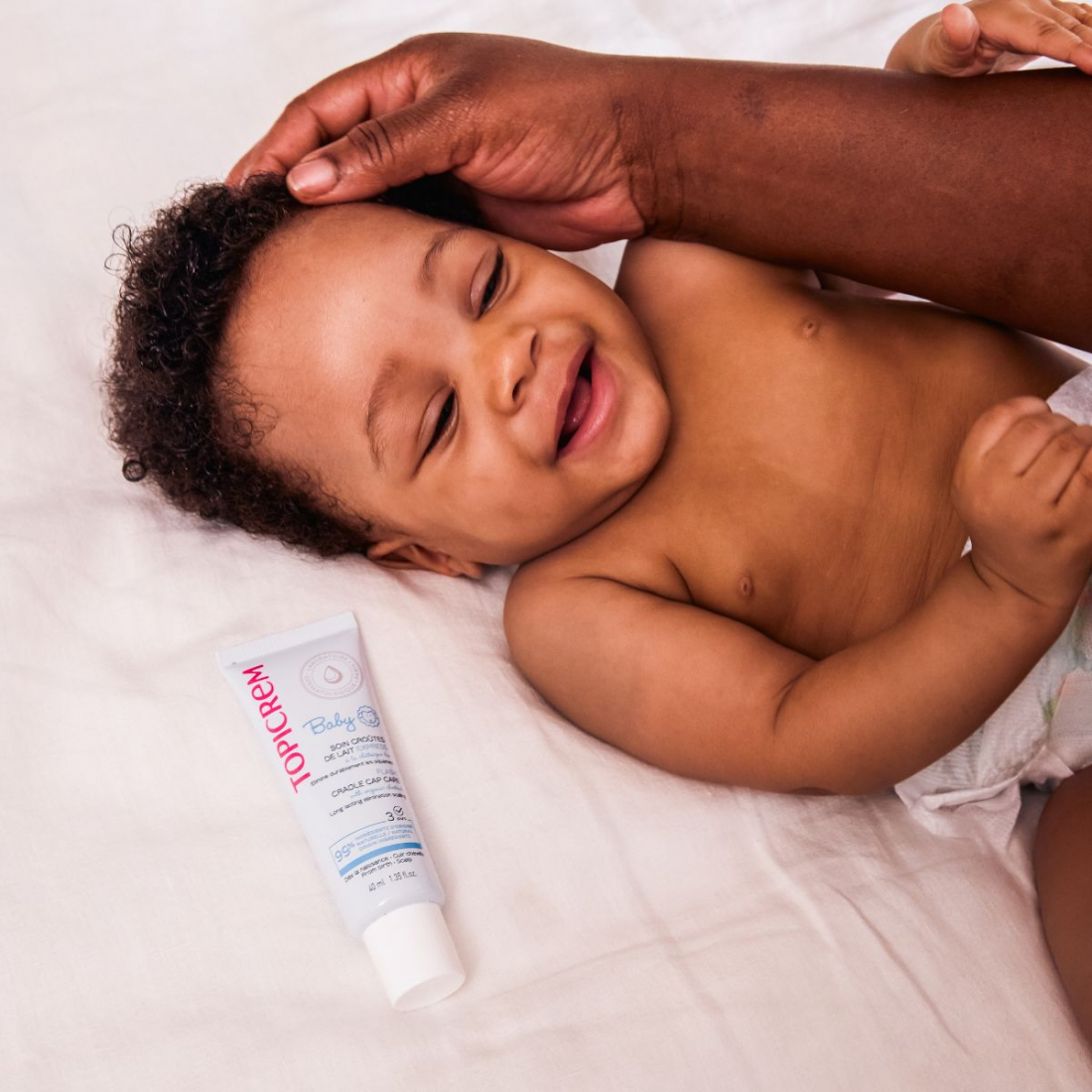 'Flash' Cradle Cap Cream - 40 ml