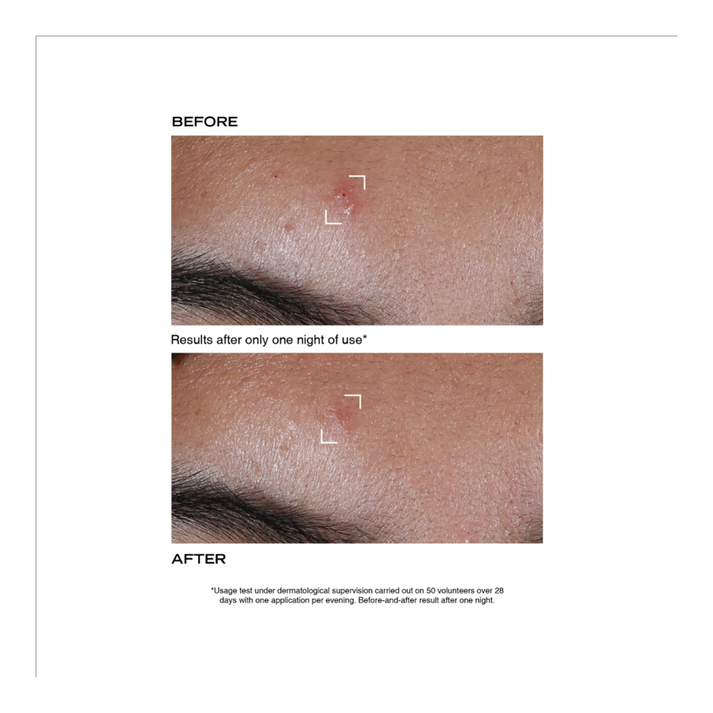 'Pâte Grise Stop Bouton' Blemish Treatment - 15 ml