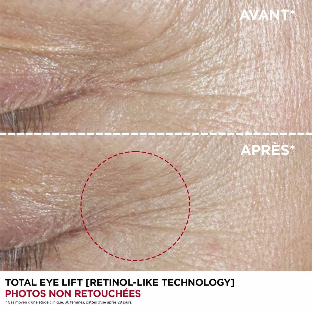 'Total Eye Lift' Eye Cream Refill - 15 ml