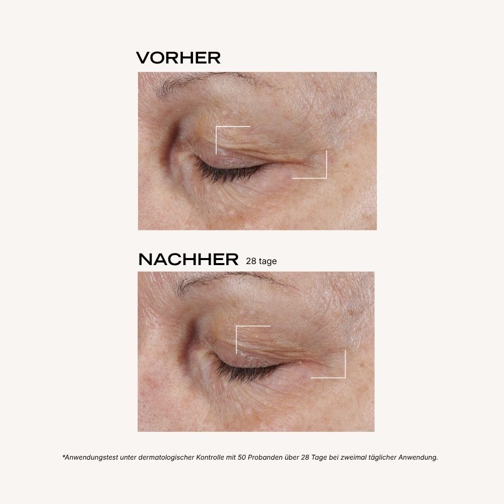 Crème contour des yeux 'Suprême Absolu Jeunesse' - 15 ml