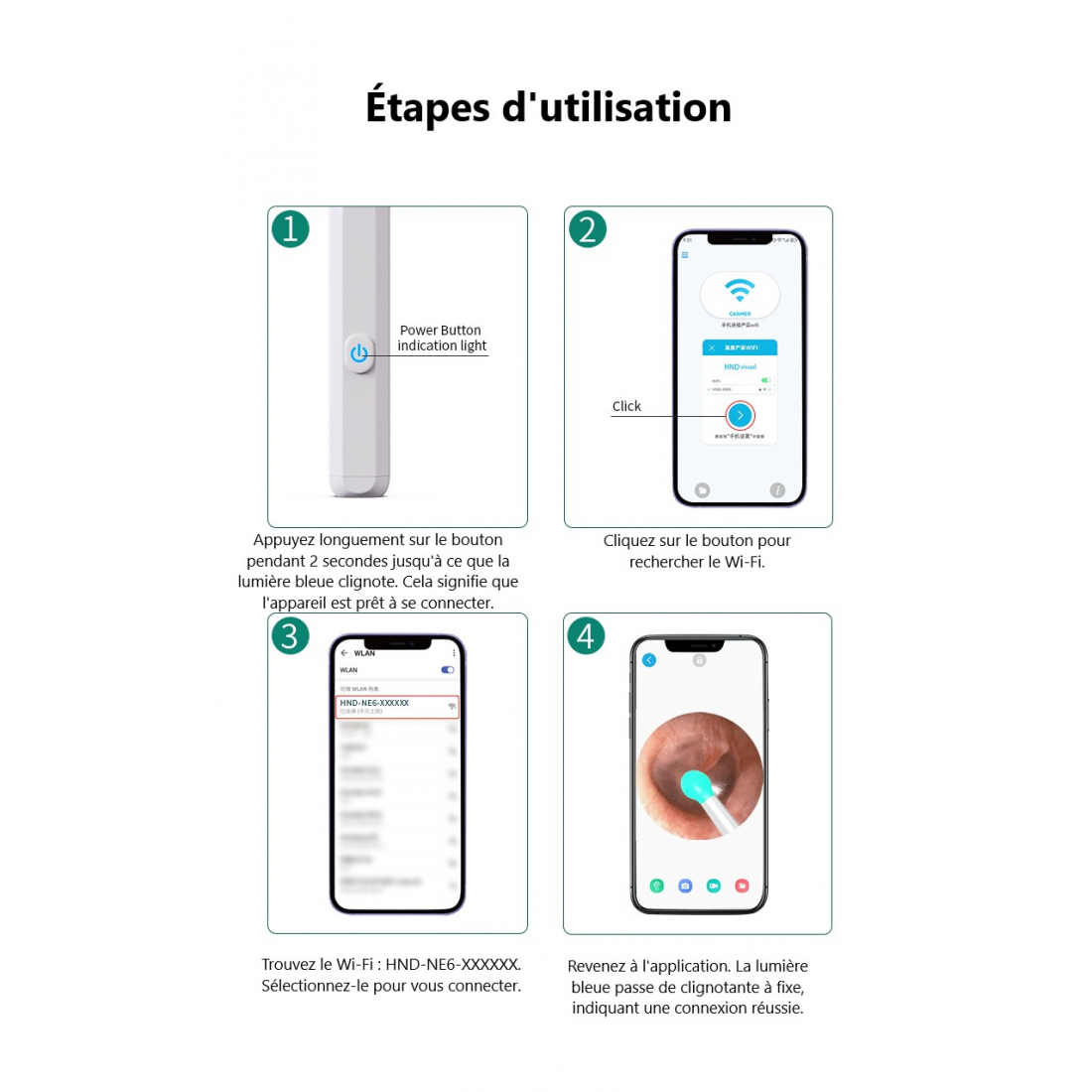 Otoskop Ohr 1080P HD Wifi Ohrreinigung