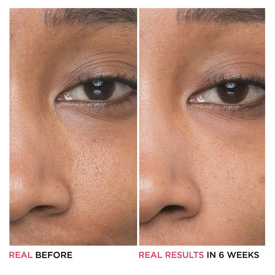 'Bye Bye Pores Glycolic Acid' Serum - 30 ml