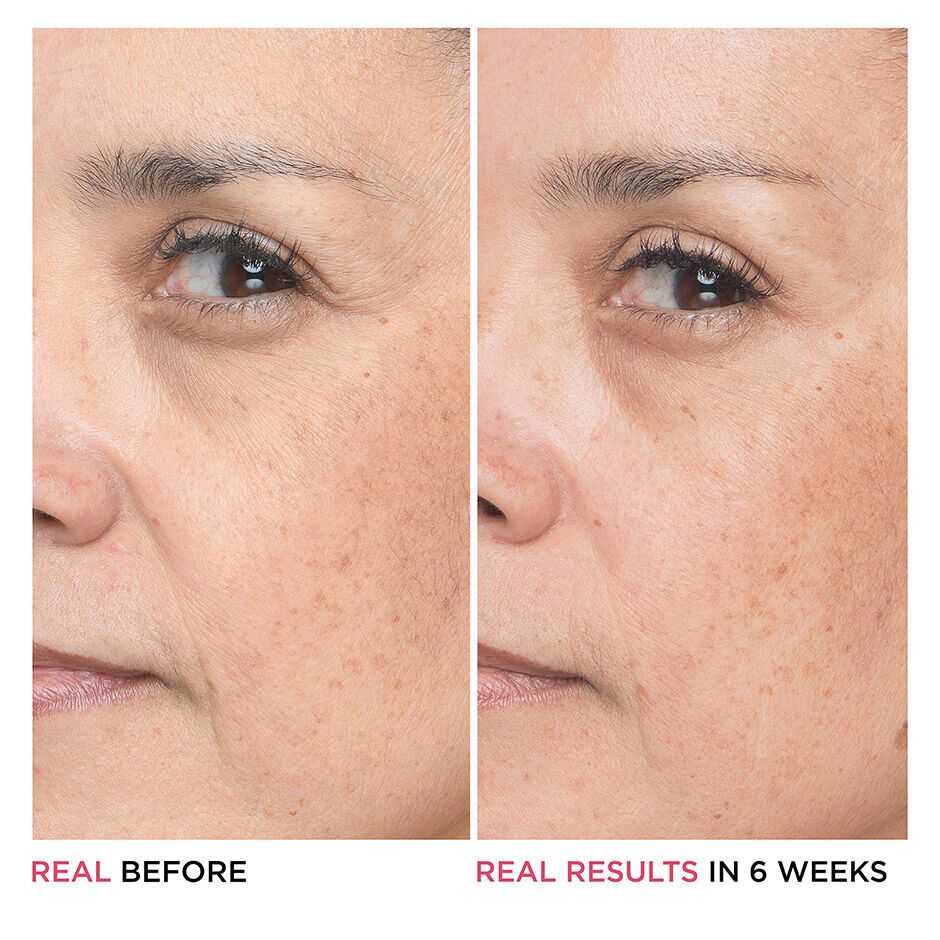 'Bye Bye Lines Hyaluronic Acid' Serum - 30 ml