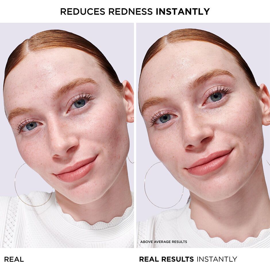 'Bye Bye Redness' Serum - 30 ml