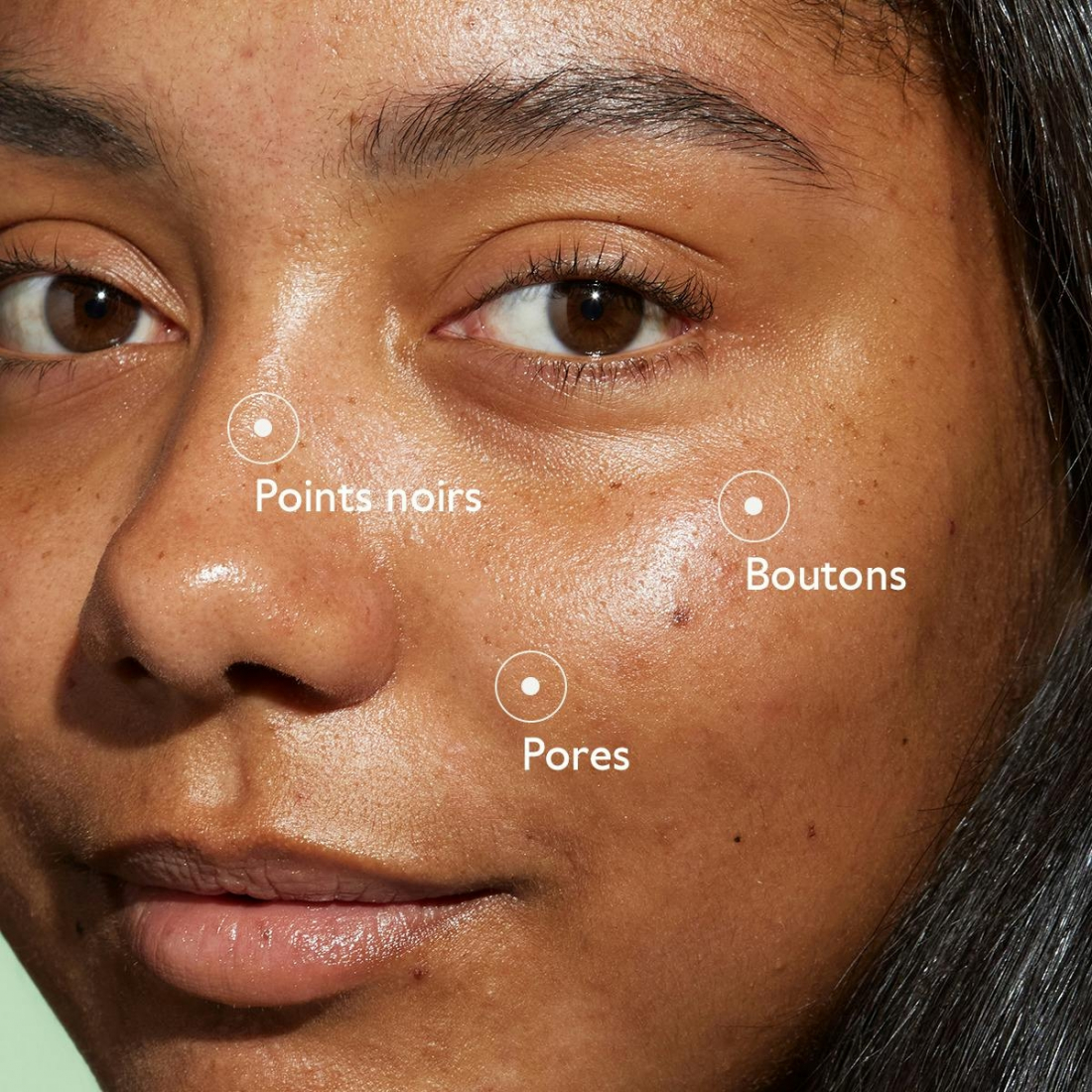 Vinopure Sérum à l'Acide Salicylique Anti-Imperfections - 30 ml