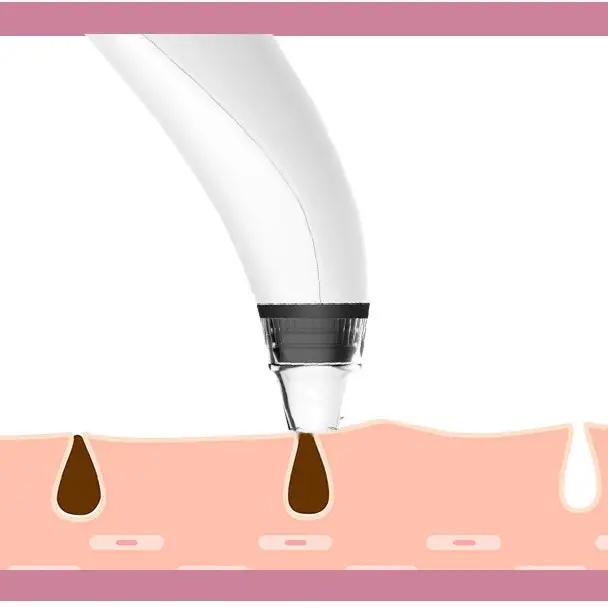 'Integrated Camera' Blackhead Vacuum