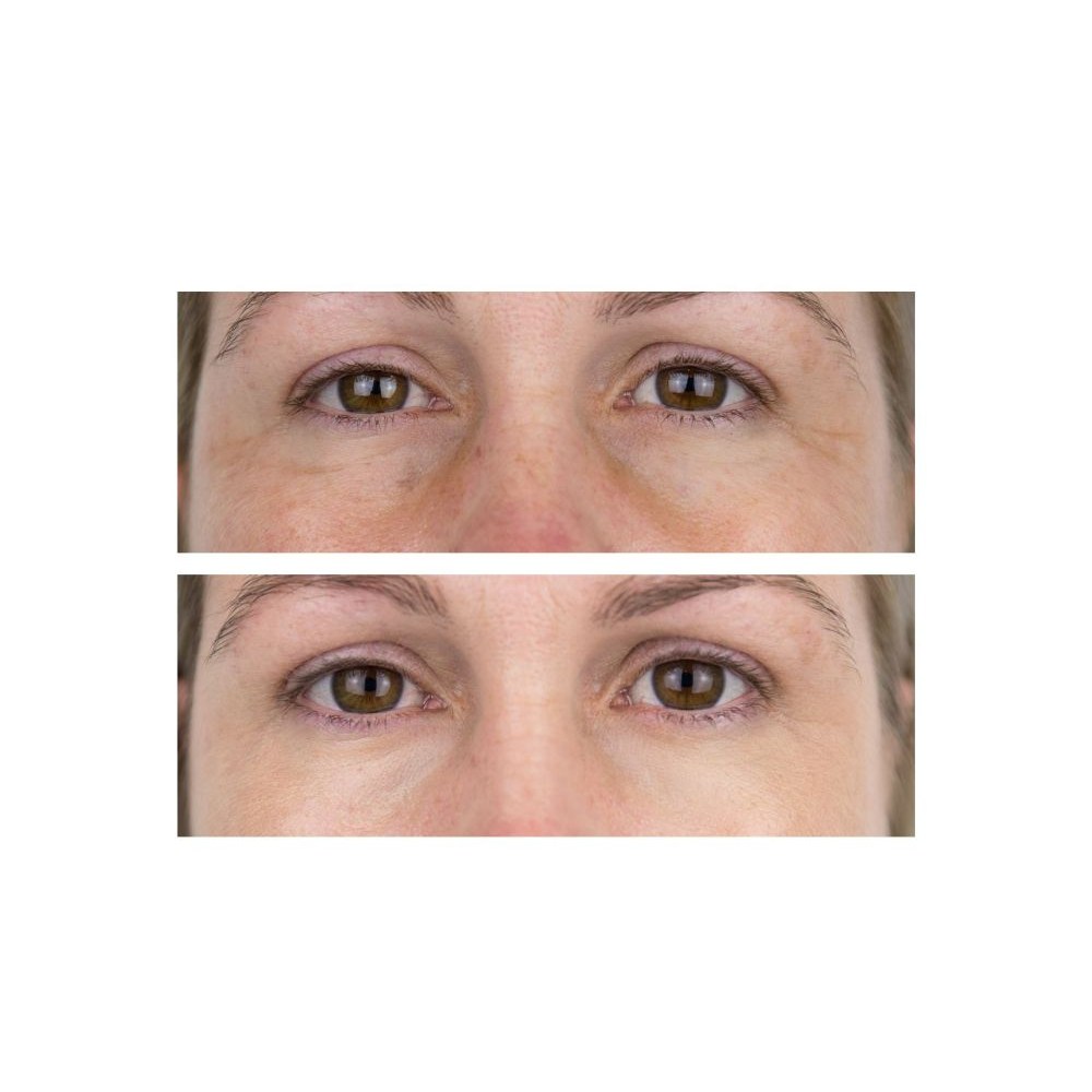 'Eye See You' Eye Care Set