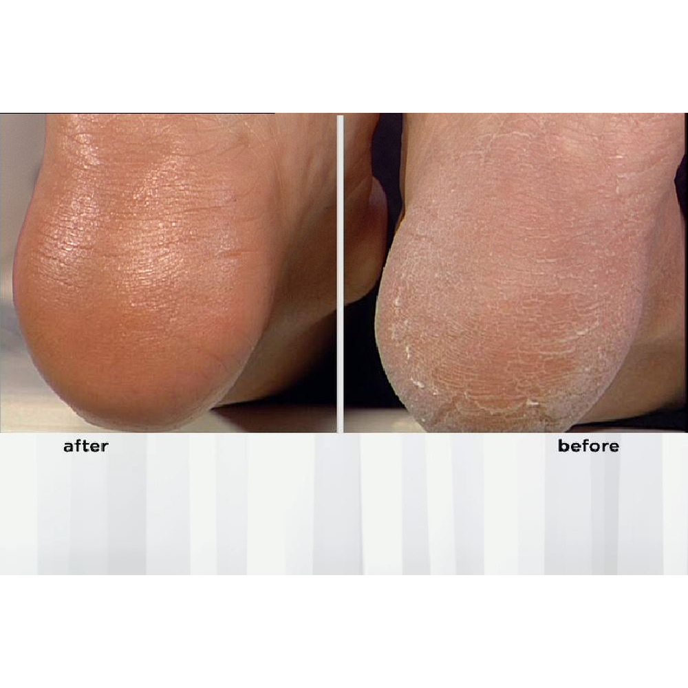 'Foot Fetish' Foot Balm - 75 g