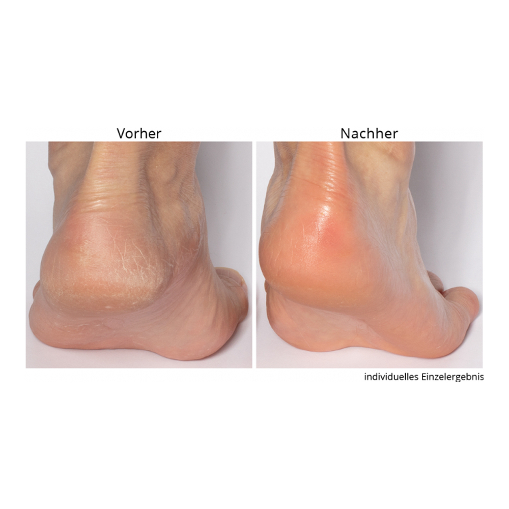 'Non-negotiable' Foot Scrub - 118 ml