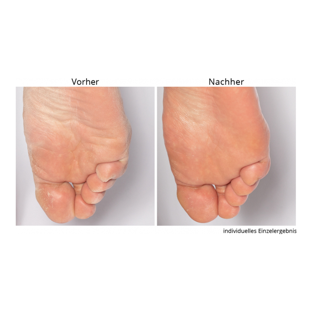 'Non-negotiable' Foot Scrub - 118 ml