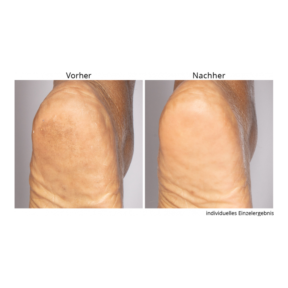 'Non-negotiable' Foot Scrub - 118 ml