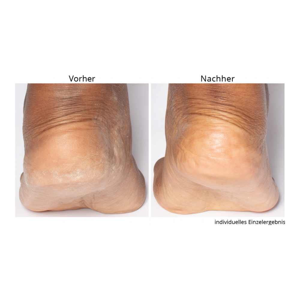 'Non-negotiable' Foot Scrub - 118 ml