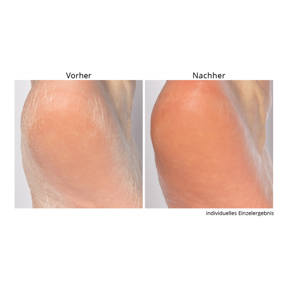 'Non-negotiable' Foot Scrub - 118 ml