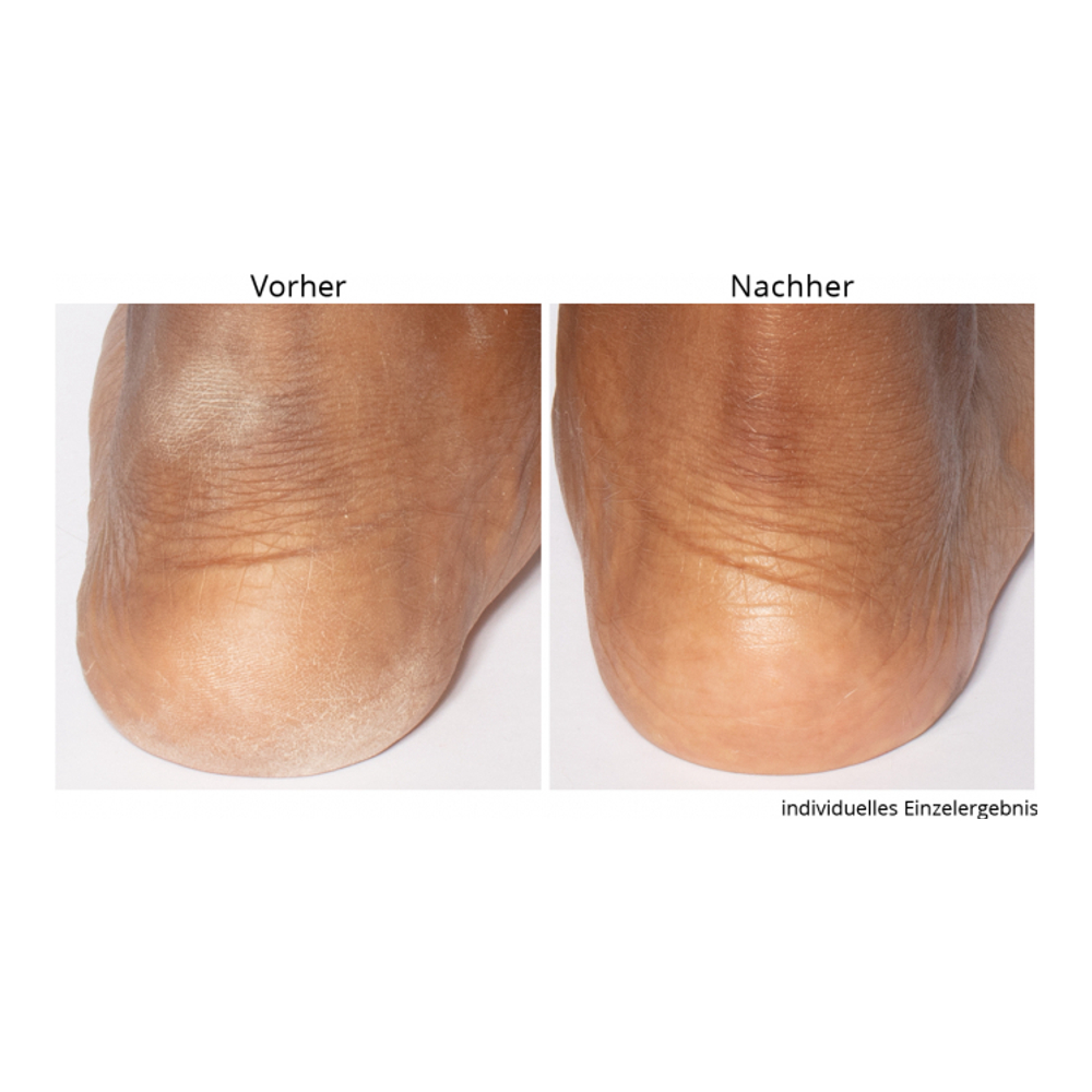 'Non-negotiable' Foot Scrub - 118 ml