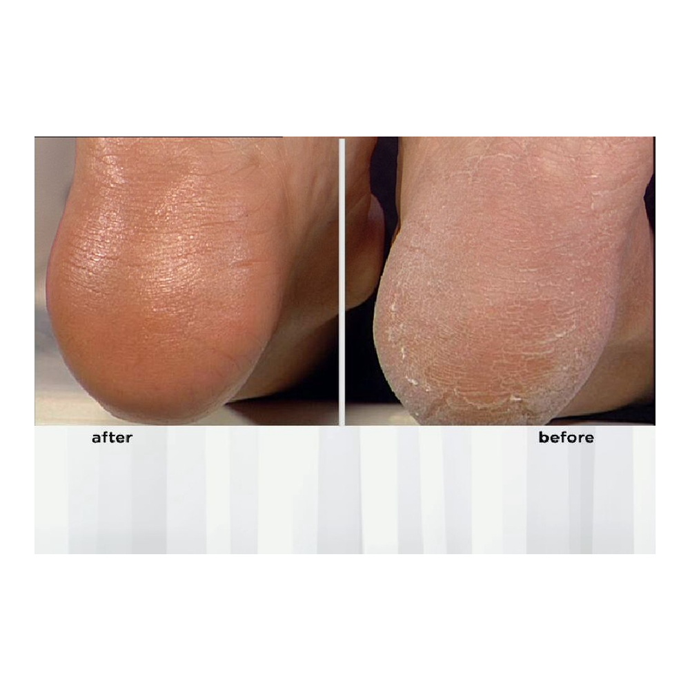 'Non-negotiable Foot Fetish' Foot Care Set - 118 ml, 75 g