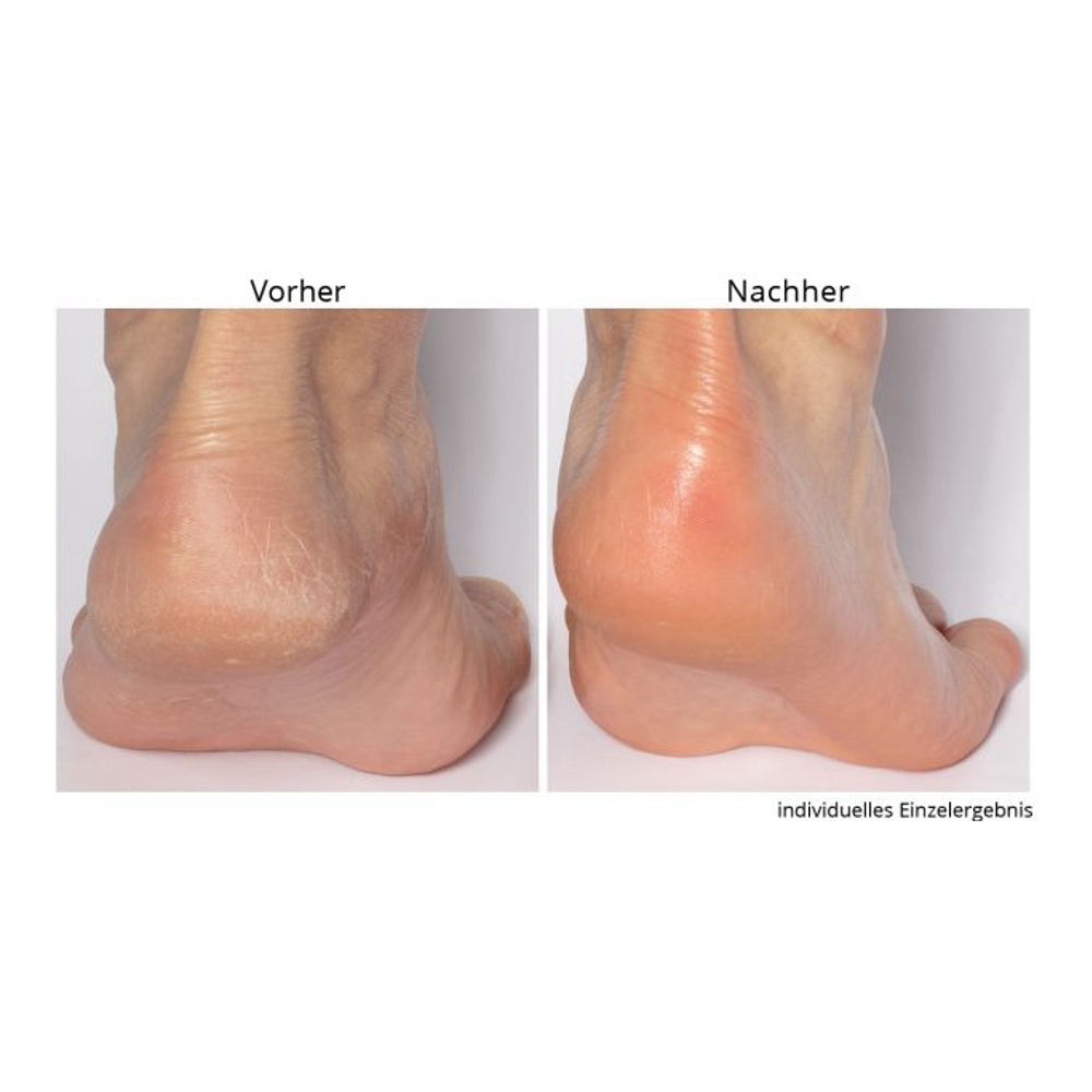 'Non-negotiable Foot Fetish' Foot Care Set - 118 ml, 75 g