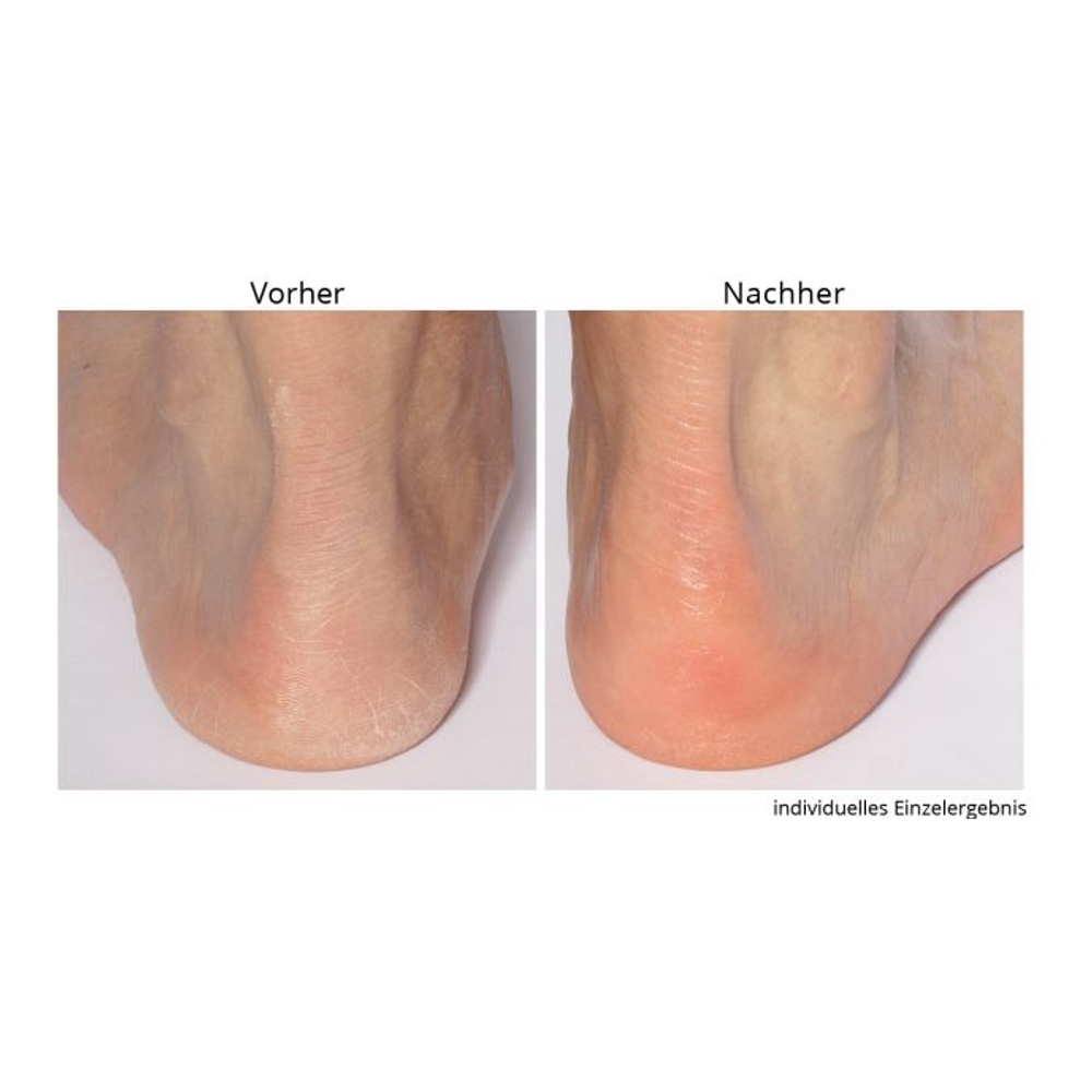 'Non-negotiable Foot Fetish' Foot Care Set - 118 ml, 75 g