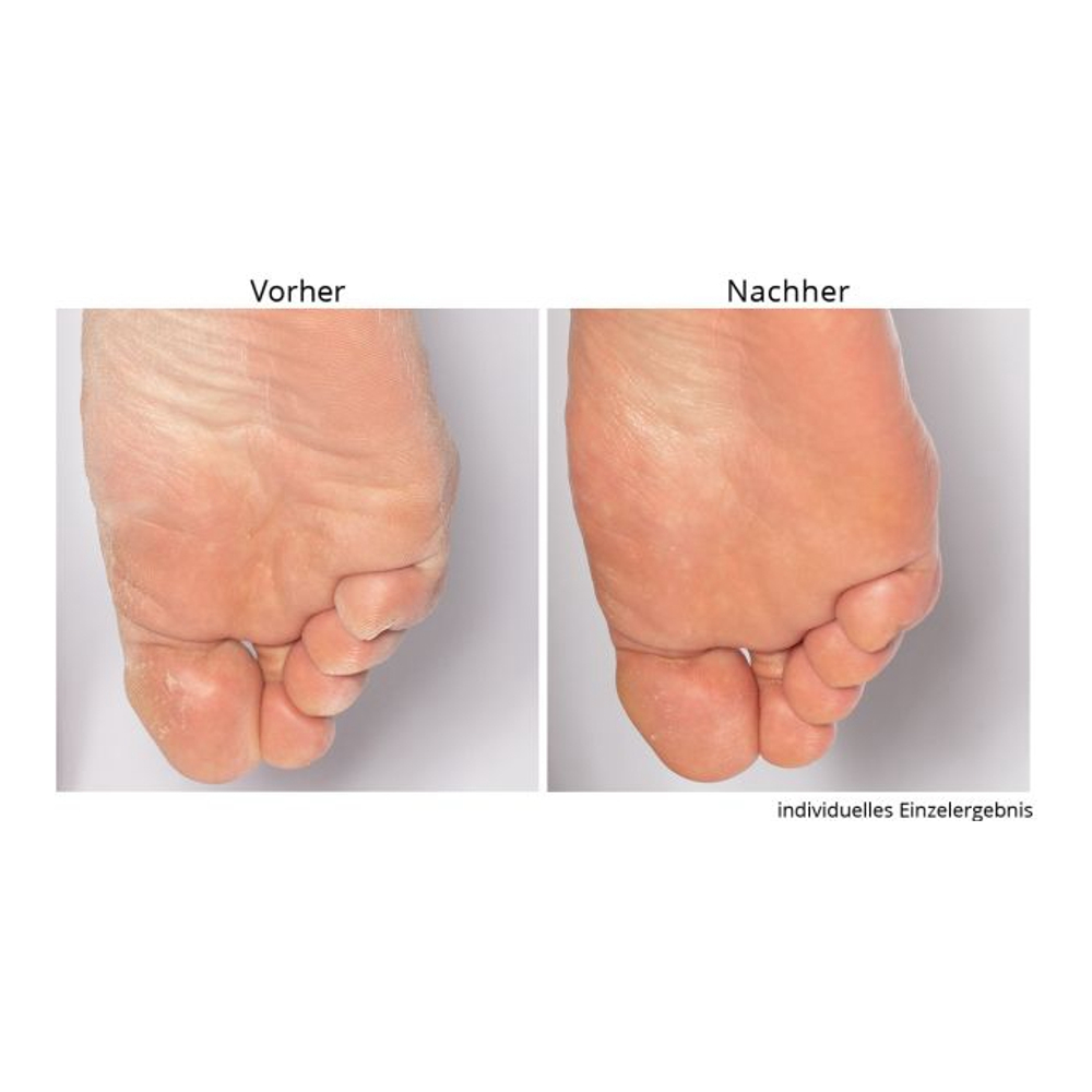 'Non-negotiable Foot Fetish' Foot Care Set - 118 ml, 75 g